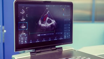 Echographie et pathologies valvulaires  quantification et prise en charge