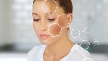 La dermoscopie dans les lésions pigmentées faciales