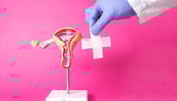 Les pathologies vaginales  du dépistage au traitement 