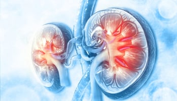 Parcours de soins du patient malade rénal chronique-2