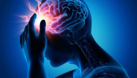 Tout savoir sur la migraine-1