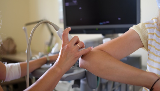 Échographie musculosquelettique – Membre supérieur