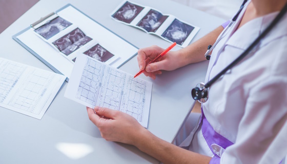 Bases de l’analyse de lECG, diagnostics des tachycardies et conduite à tenir